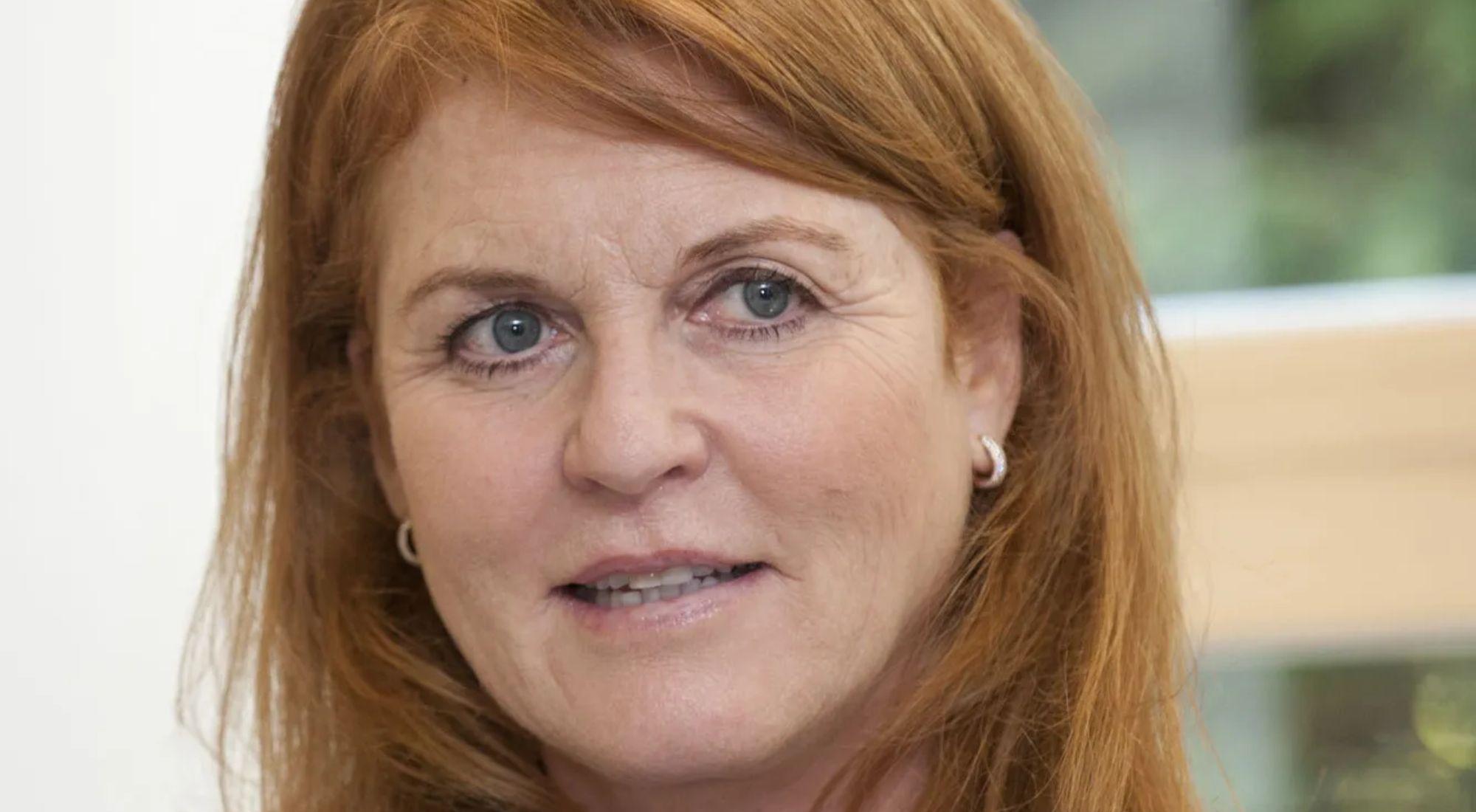 Sarah Ferguson, Duquesa de York, enfrenta un melanoma maligno